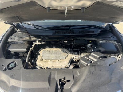 2015 Acura MDX Technology Package